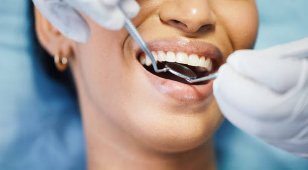 Best Emergency Denture Repair in South Greeley, WY